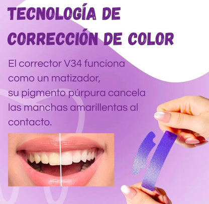 Smilekit Cintas Blanqueadoras x14