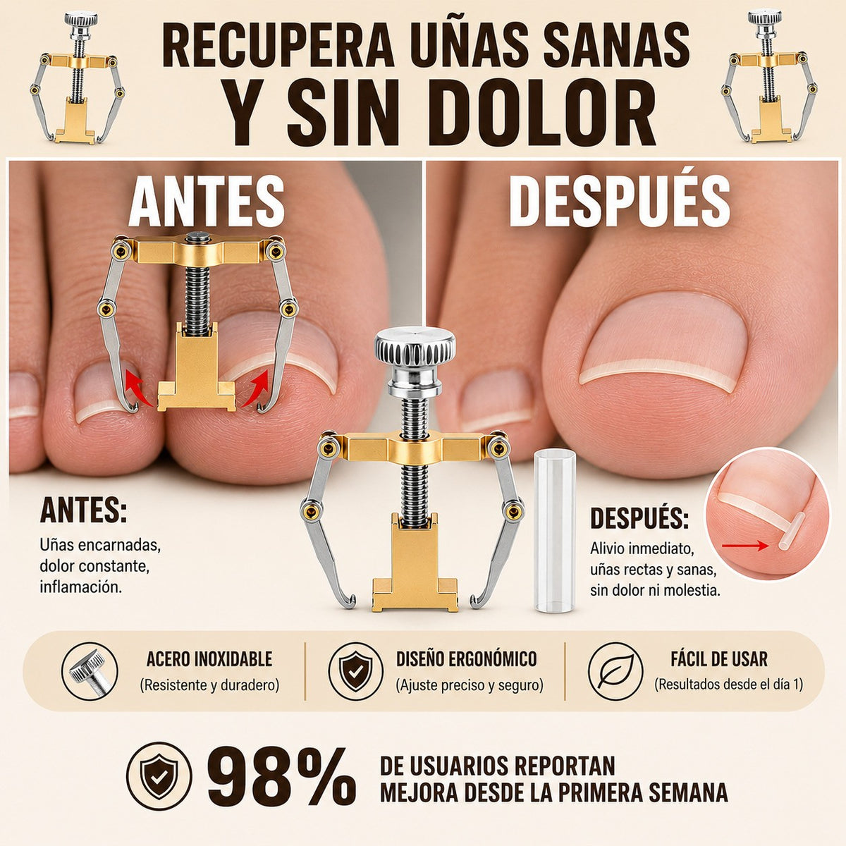 Corrector para Uñas Encarnadas +  30 Tiras de Higiene