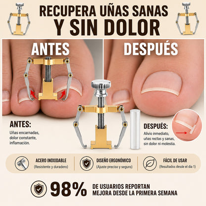 Corrector para Uñas Encarnadas +  30 Tiras de Higiene