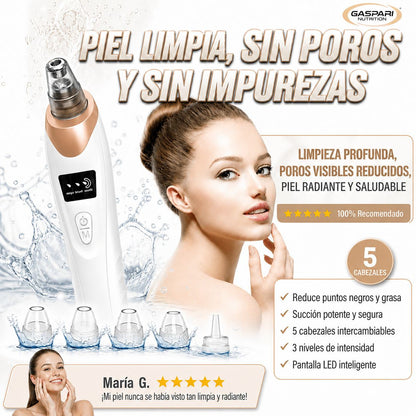 Extractor de puntos negros