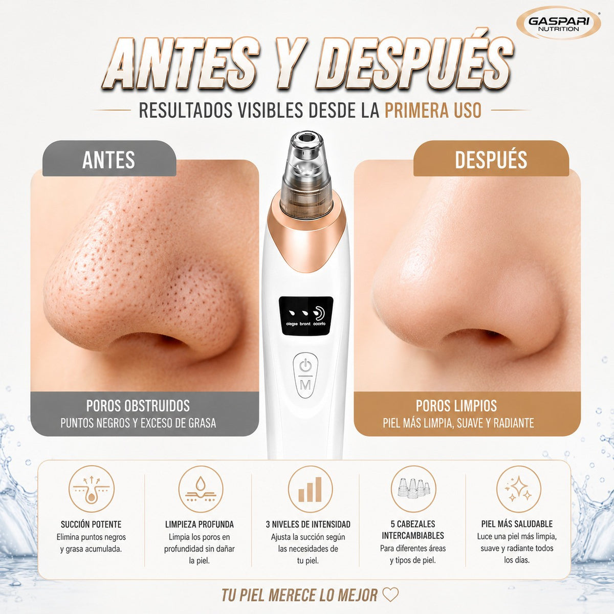 Extractor de puntos negros