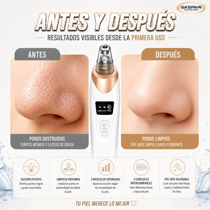 Extractor de puntos negros